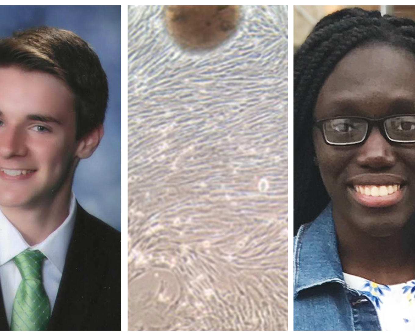 Ethan Trim '22 (left) and Nakesha Agyapong '22 (right) study lung stem cell aging in canines, such as this slide that depicts lung stem cells moving across a culture plate from a piece of lung tissue (center).