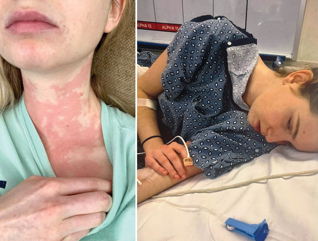 Two images of Caroline Quinn with a rash and in the hospital